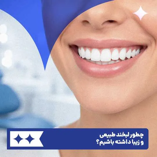 چطور لبخند طبیعی و زیبا داشته باشیم؟