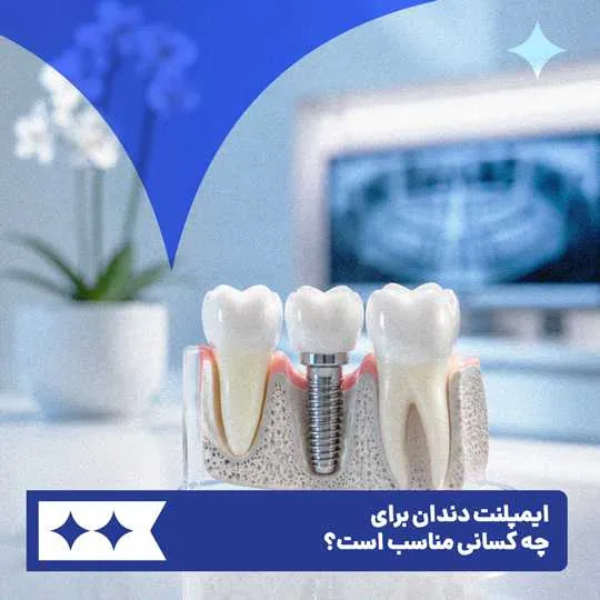 ایمپلنت دندان برای چه کسانی مناسب است؟